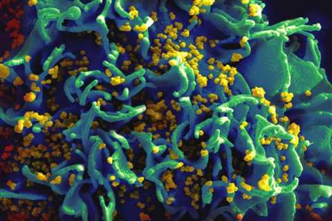 J&J Stops Work on HIV Vaccine After Failure in Phase 3 Clinical Trial