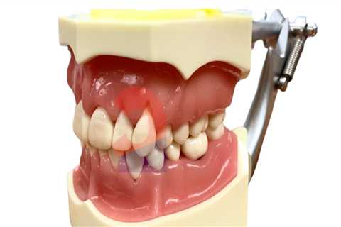 What Type of Dental Supplies are Used for Periodontal Treatments?