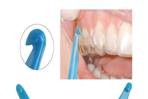 What Type of Dental Supplies are Used to Make Orthodontic Appliances?