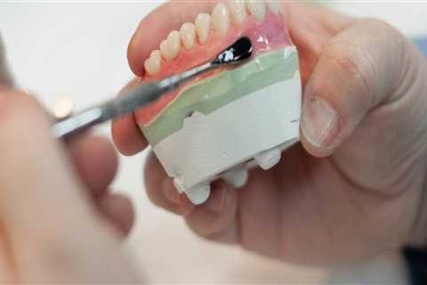 What Type of Dental Supplies are Used to Make Temporary Dentures?