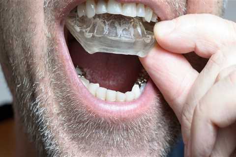 Do I Need a Special Mouthguard After Oral Surgery?