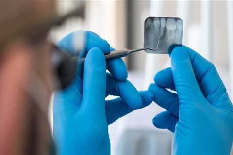 The Benefits of Endodontic Treatment: Why Save Your Natural Tooth