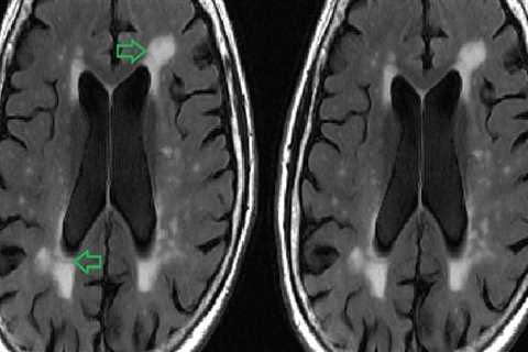 Special Considerations for Elderly Patients Undergoing Medical Imaging Tests