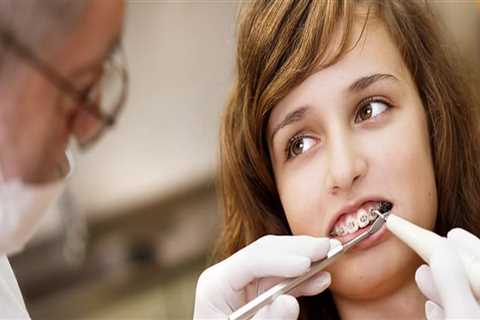 Enhancing Your Child's Smile: Visiting A Dentist For Orthodontic Braces In London