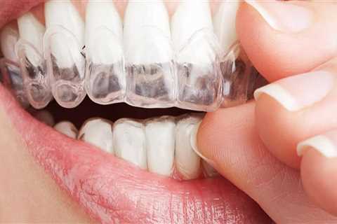 6 Warning Signs That You Need Invisalign Orthodontics Treatment In Spring, TX