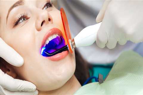 San Antonio Secrets: The Vital Role Of Endodontists In Teeth Whitening