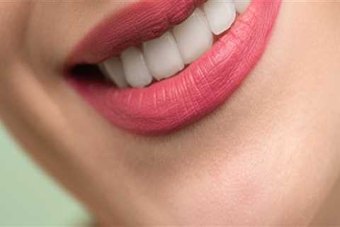 The Significance Of Dentists Open On Saturdays In Sterling, Virginia, For Teeth Whitening