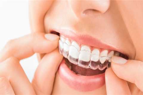 The Best Orthodontic Practices In Canberra For Adult Braces