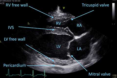 Focused Cardiac Ultrasound (FCU) Examination with Dr. Christopher Kennedy | VETgirl Veterinary..