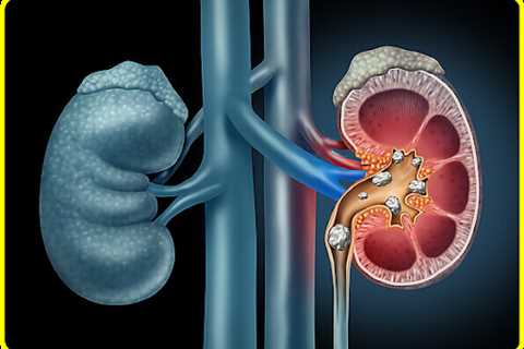 Get all your renal problems solved by the best nephrologists in Delhi