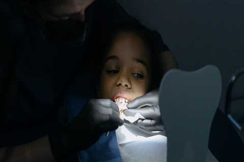 Why Wisdom Tooth Extraction In London Requires The Expertise Of A Health Consultant