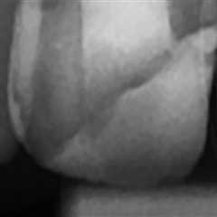 The Role Of Medical Imaging In Pain Management: A Look At Local Massage Facilities In Buffalo, NY