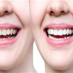 Cracked Or Chipped Bicuspids? Why Immediate Care From An Ashburn Dentist Is Important