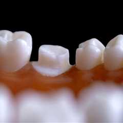 How Endodontics and Orthodontics Unite for Oral Health