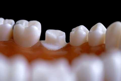 How Endodontics and Orthodontics Unite for Oral Health