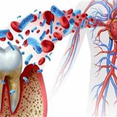 The Hidden Connection Between Inflammation and Periodontal Disease