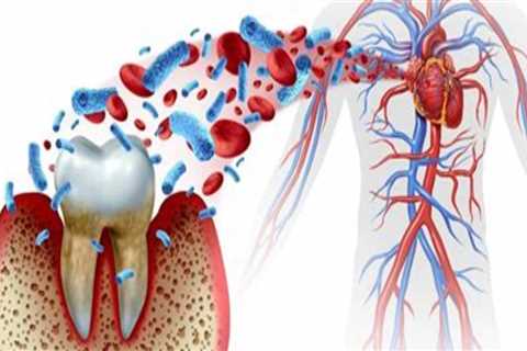 The Hidden Connection Between Inflammation and Periodontal Disease
